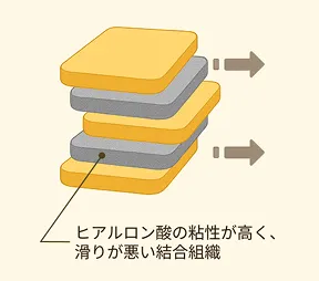 筋膜が不調な状態